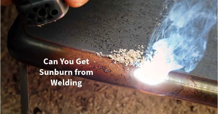 Can you get a sunburn from welding